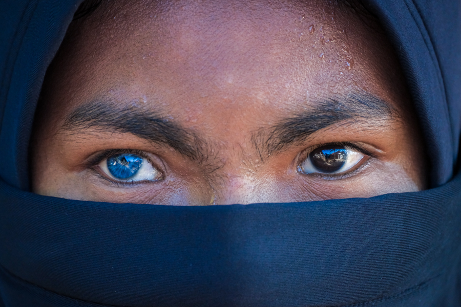 Butonese girl with beautiful eyes, one blue and one brown